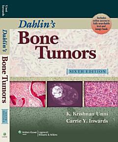 Dahlin\'s Bone Tumors