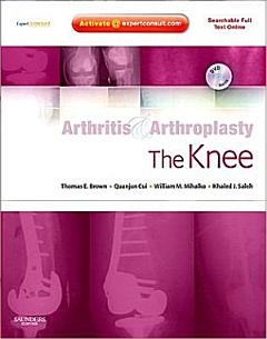 Arthritis & Arthroplasty