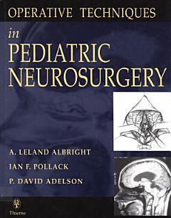 Operative Techniques in Pediatric Neurosurgery