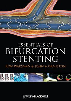 Bifurcation Stenting