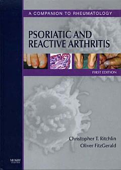 Psoriatic and Reactive Arthritis E-Book