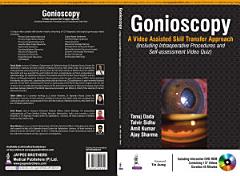 Gonioscopy