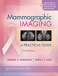 Mammographic Imaging