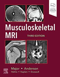 Musculoskeletal MRI E-Book