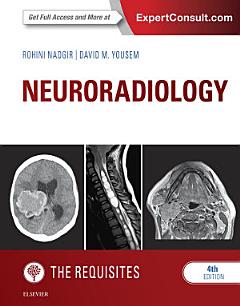 Neuroradiology: The Requisites E-Book