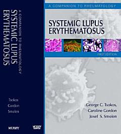 Systemic Lupus Erythematosus