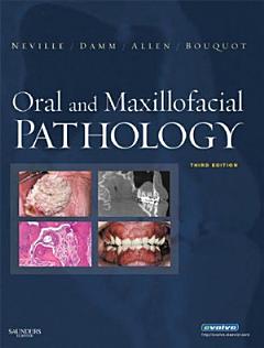 Oral and Maxillofacial Pathology - E-Book