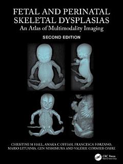 Fetal and Perinatal Skeletal Dysplasias