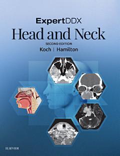 ExpertDDX: Head and Neck - E-Book