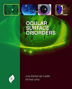 Ocular Surface Disorders