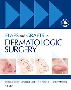 Flaps and Grafts in Dermatologic Surgery E-Book