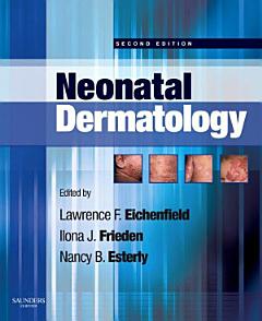 Neonatal Dermatology E-Book