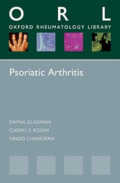 Psoriatic Arthritis