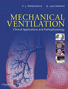 Mechanical Ventilation E-Book