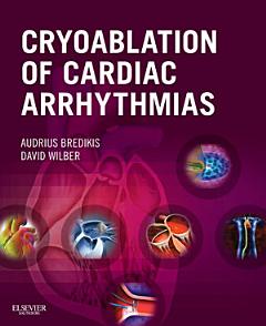 Cryoablation of Cardiac Arrhythmias E-Book