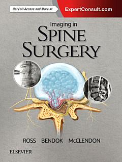 Imaging in Spine Surgery E-Book