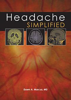 Headache Simplified