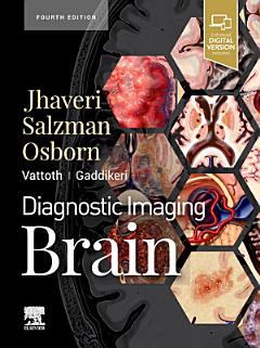 Diagnostic Imaging: Brain E-Book