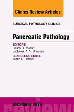 Obstructive Sleep Apnea, An Issue of Otolaryngologic Clinics of North America