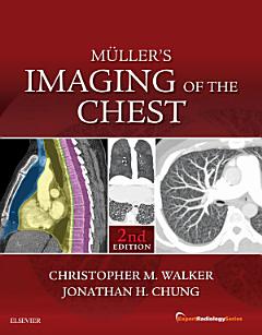 Muller\'s Imaging of the Chest E-Book