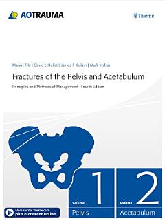 Fractures of the Pelvis and Acetabulum