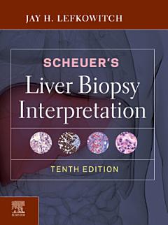 Scheuer\'s Liver Biopsy Interpretation