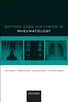 Oxford Case Histories in Rheumatology