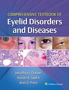 Comprehensive Textbook of Eyelid Disorders and Diseases