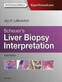 Scheuer\'s Liver Biopsy Interpretation