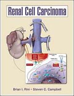 Renal Cell Carcinoma