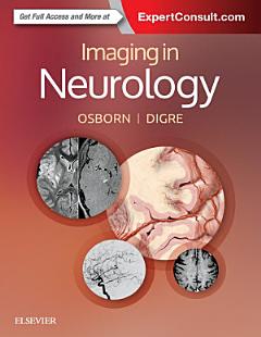 Imaging in Neurology E-Book