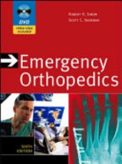 Emergency Orthopedics