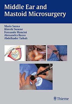 Middle Ear and Mastoid Microsurgery