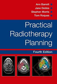 Practical Radiotherapy Planning