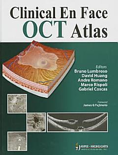 Clinical En Face OCT Atlas