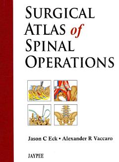 Surgical Atlas of Spinal Operations