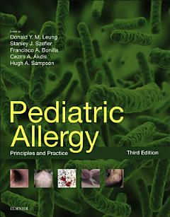 Pediatric Allergy: Principles and Practice E-Book