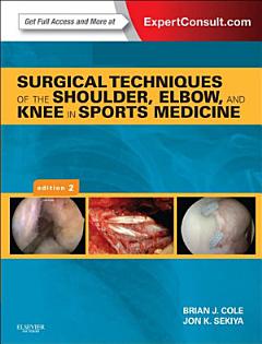 Surgical Techniques of the Shoulder, Elbow and Knee in Sports Medicine E-Book