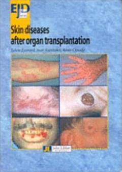 Skin Diseases After Organ Transplantation