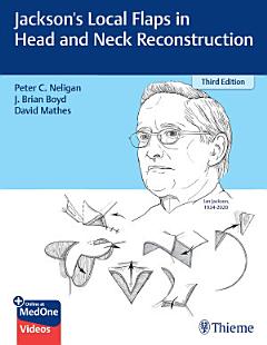 Jackson\'s Local Flaps in Head and Neck Reconstruction