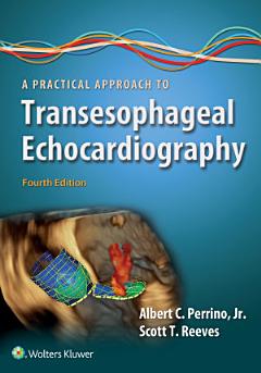 A Practical Approach to Transesophageal Echocardiography