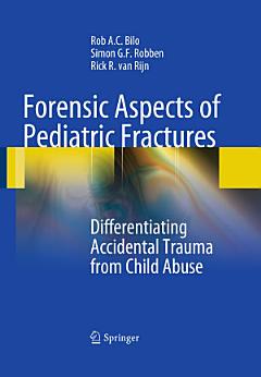 Forensic Aspects of Pediatric Fractures