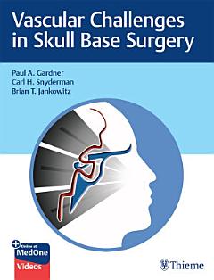 Vascular Challenges in Skull Base Surgery