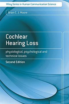 Cochlear Hearing Loss