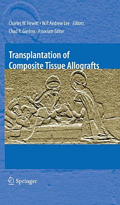 Transplantation of Composite Tissue Allografts