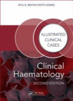 Clinical Haematology, Second Edition