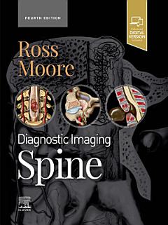 Diagnostic Imaging: Spine - E-Book