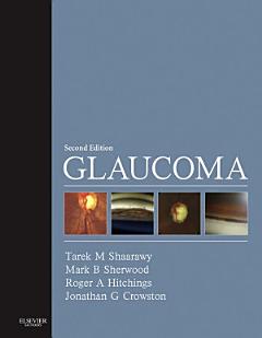 Glaucoma E-Book