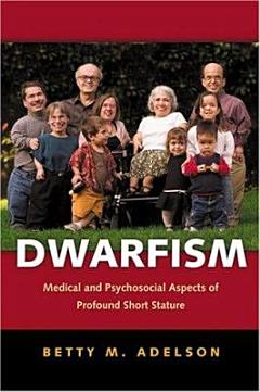 Dwarfism