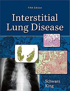 Interstitial Lung Disease